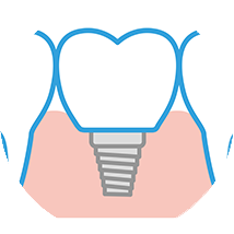 インプラント・歯科口腔外科